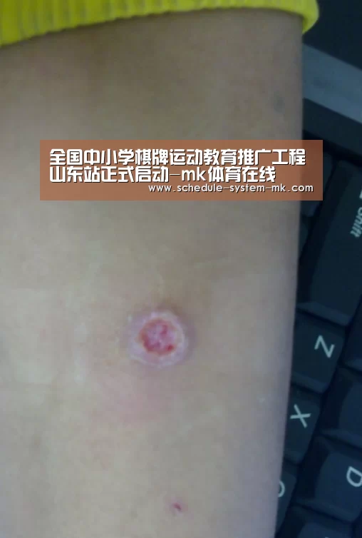 mk体育注册